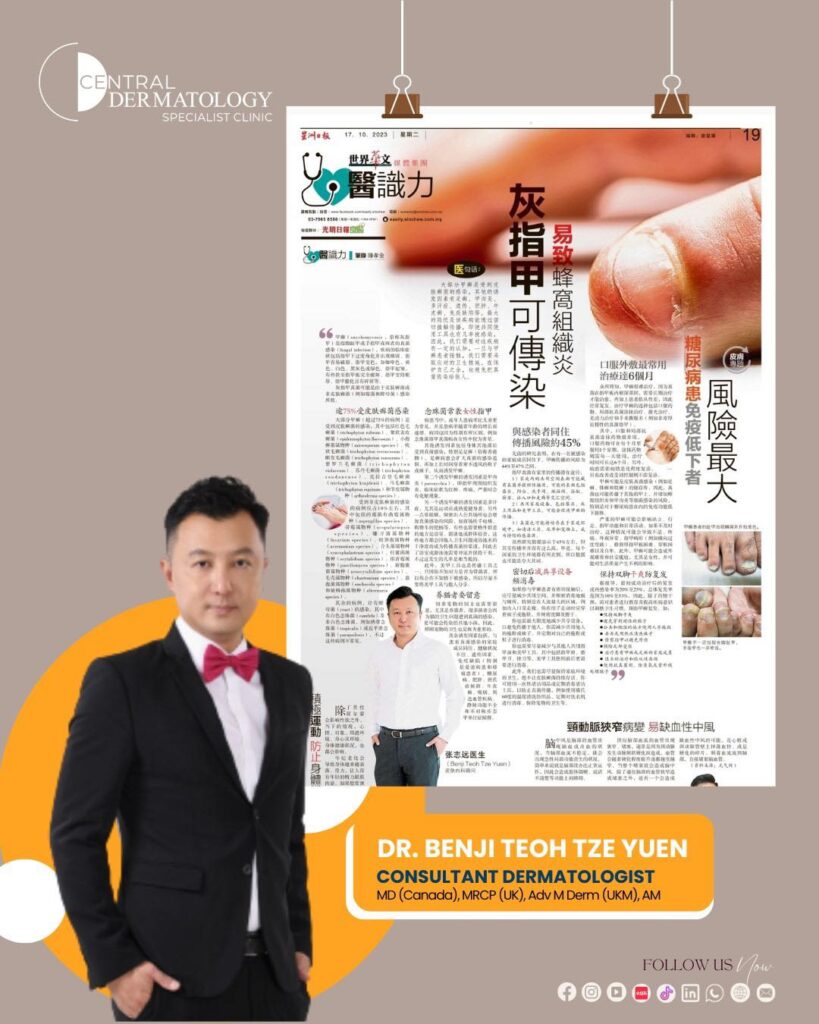Bulletin 1 -SinChew Dr Benji Grey Nails