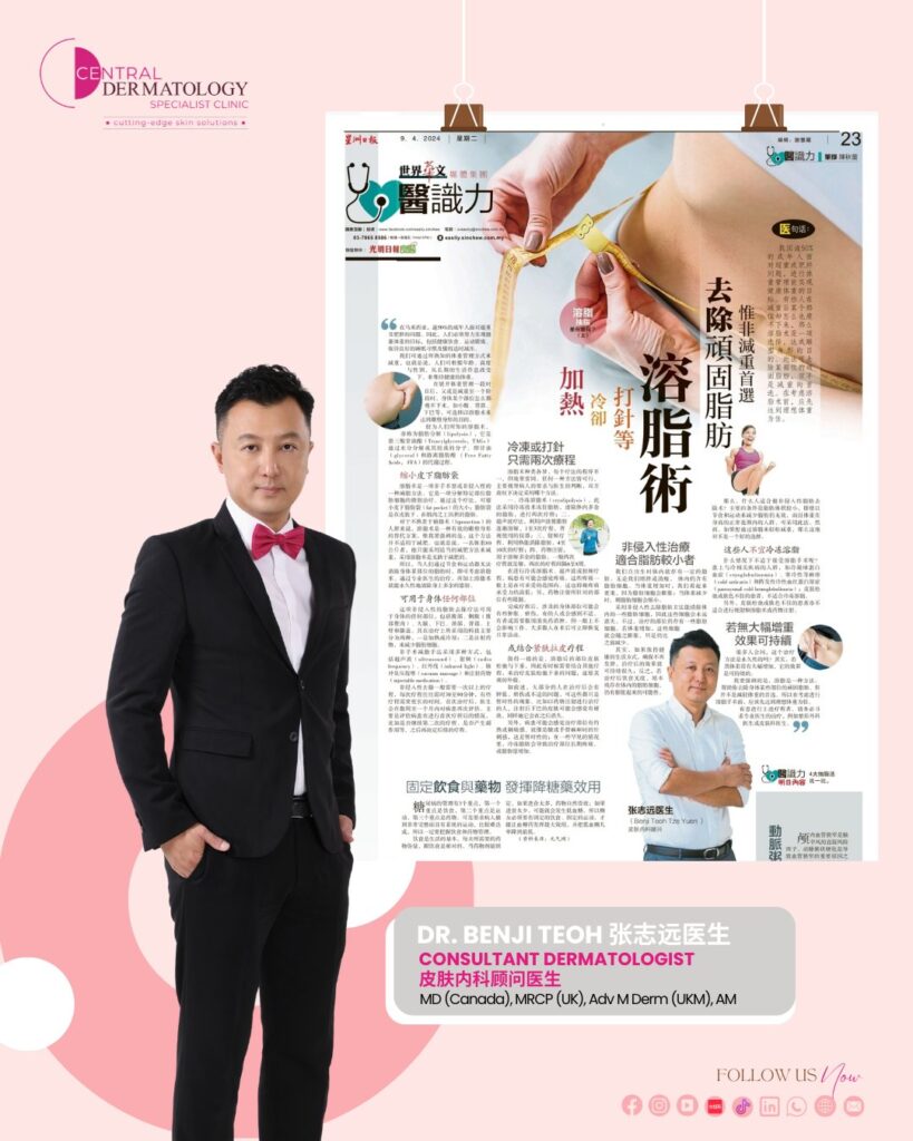 Bulletin 2 -SinChew Dr Benji Cryolipolysis